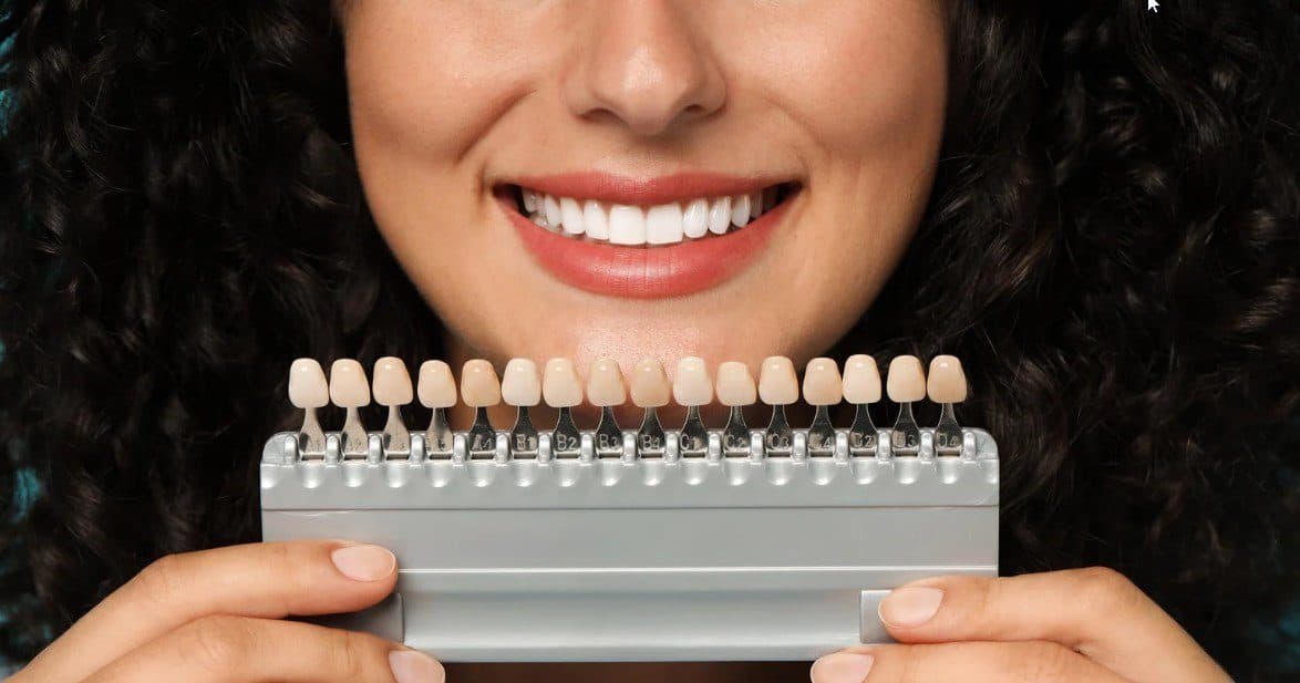Frequently Asked Questions at Carlton Dental, Downtown Toronto