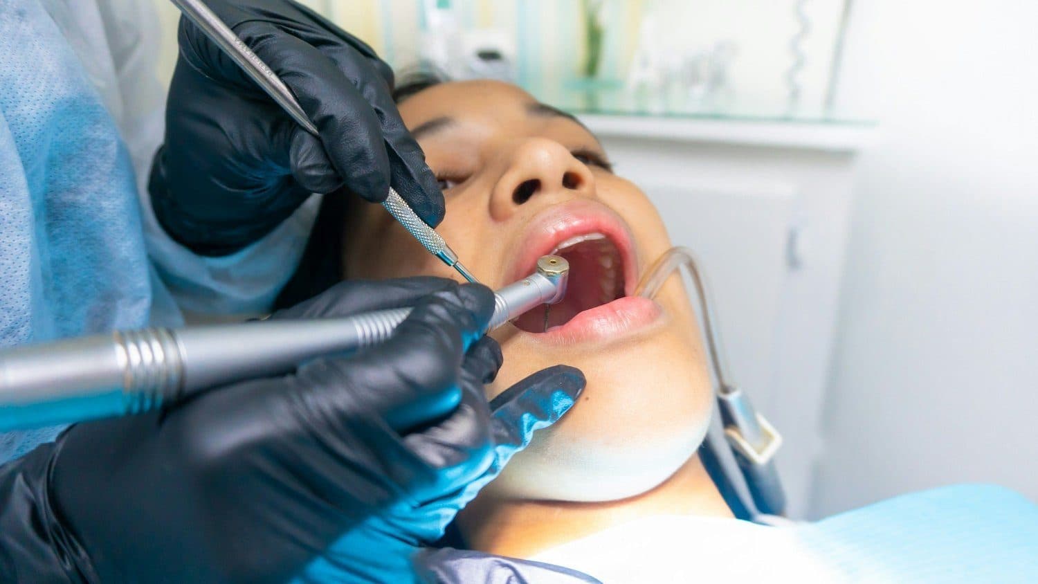 Dental Crowns & Bridges at Carlton Dental, Downtown Toronto
