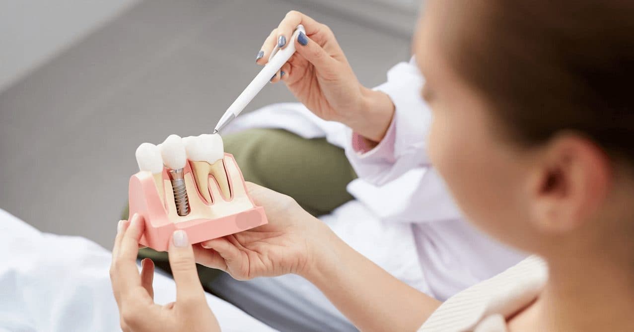 Dental Implants at Carlton Dental, Downtown Toronto