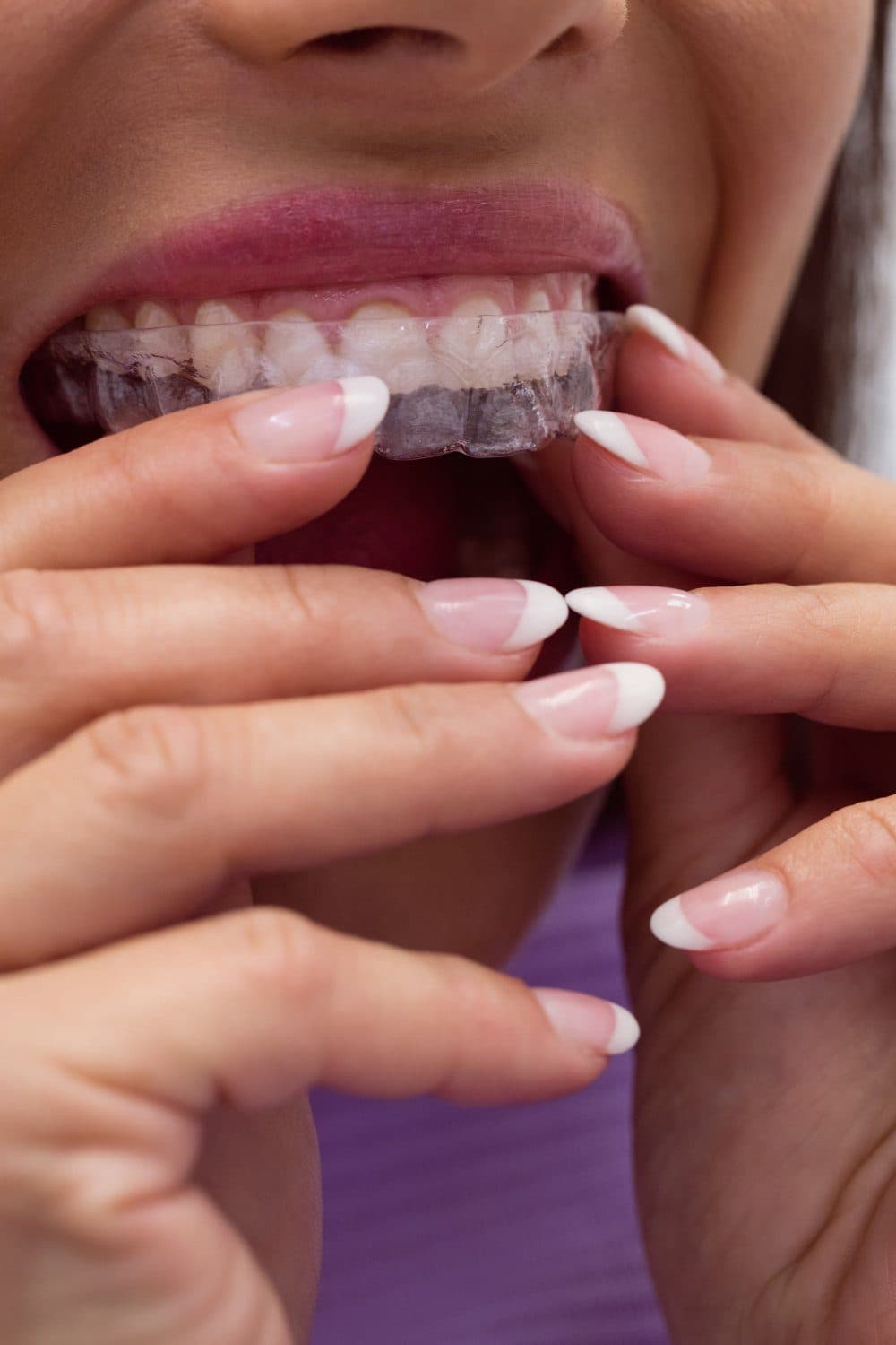 Comprehensive Examinations at Carlton Dental, Downtown Toronto