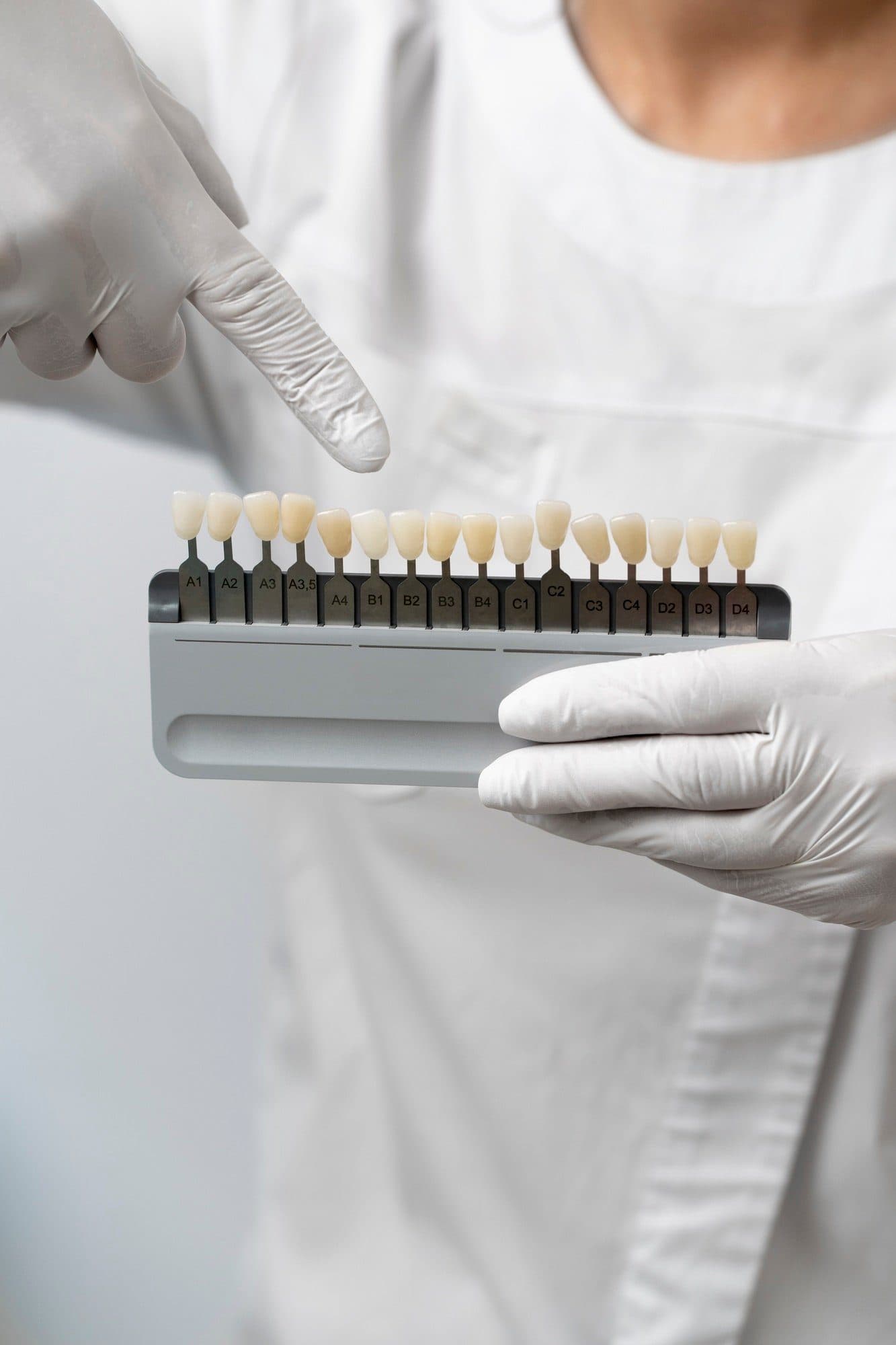 Cosmetic Dentistry at Carlton Dental, Downtown Toronto